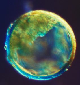 Photographie ovule fécondé Poussières d'étoile